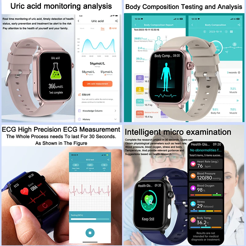 2025 New ECG+PPG Monitoring Sm - Xiaomi Luxury Watch recensione e prezzo